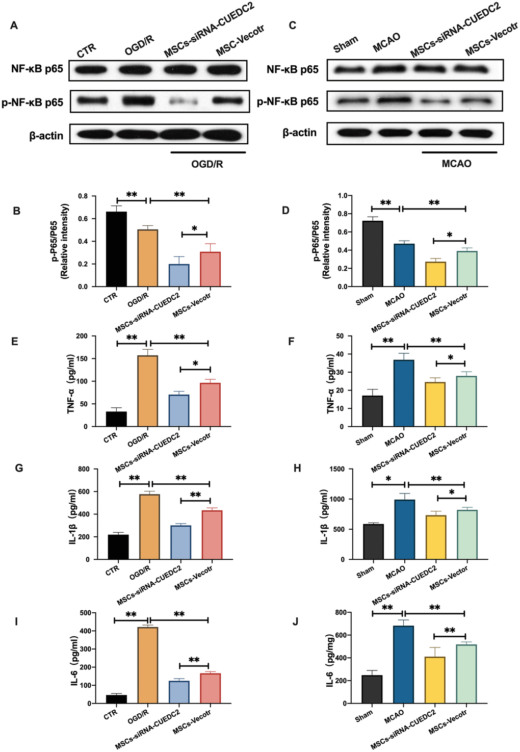 CUEDC2 silencing in MSCs suppresses NF-kB activity following cerebral I/R injury. (A, B) NF-kB and p-NF-kB protein expression in co-cultured neurons as detected by western blotting. (C, D) NF-kB and p-NF-kB protein expression in brain tissues as detected by western blotting. (E) TNF-α level in co-cultured neurons as detected by ELISA assay. (F) TNF-α level in brain tissues as analyzed by ELISA assay. (G) IL-1β level in co-cultured neurons as determined by ELISA assay. (H) IL-1β level in brain tissues as analyzed by ELISA assay. (I) IL-6 level in co-cultured neurons as evaluated by ELISA assay. (J) IL-6 level in brain tissues as determined by ELISA assay. CTR: control; CUEDC2: CUE domain-containing 2; OGD/R: oxygen-glucose deprivation (4 hours) and reperfusion (24 hours). MSCs: mesenchymal stem cells; MSCs-siRNA-CUEDC2: small interfering RNA silencing CUEDC2 in MSCs; MSCs-vector: the vector of MSCs; MCAO, middle cerebral artery occlusion. All data are presented as the mean value ± SD. *p