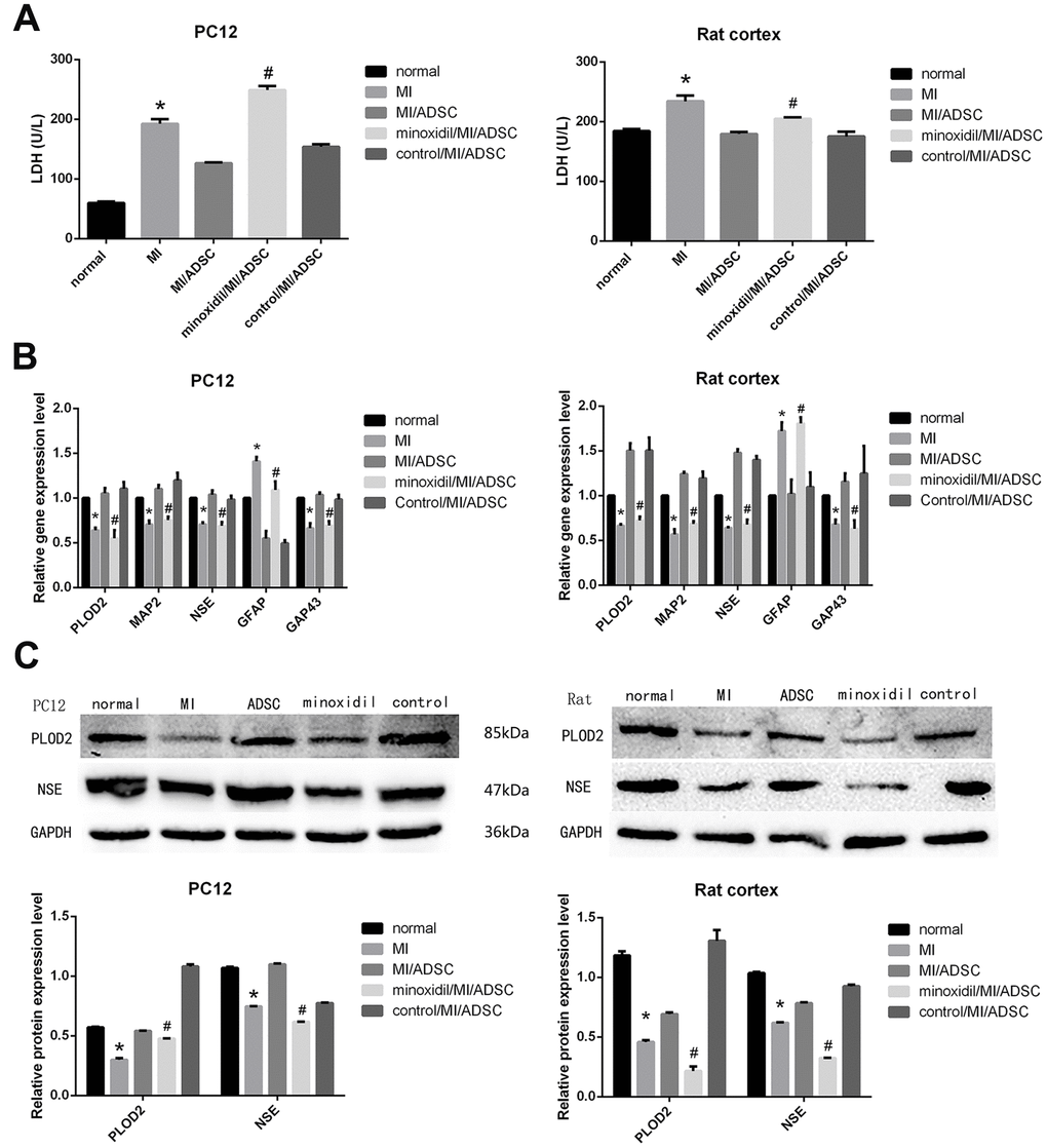 Inhibited the expression of PLOD2 by minoxidil, the neurorestorative effect of ADSCs was weakened. (A) LDH release assay result from MI-exposed cells co-cultured with ADSCs in the presence or absence of minoxidil. (B) Analysis of PLOD2, MAP2, NSE, GAP43, and GFAP transcript expression in MI-treated neurons co-cultured with ADSCs in the presence or absence of minoxidil. (C) Western blot analysis of PLOD2 and neuronal markers. Results presented as mean ± SD and evaluated with one-way ANOVA. *PP