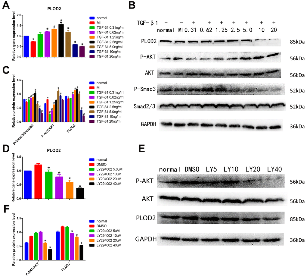TGF-β1/Smad3 pathway activation mediates ADSC-induced PLOD2 expression in neurons in vitro. (A) Analysis of PLOD2 expression via qRT-PCR in PC12 cells treated with different concentrations of TGF-β1. (B, C) Western blot analysis of PLOD2, P-AKT, AKT, P-Smad3, and Smad2/3 expression in PC12 cells treated with different concentrations of TGF-β1. (D) Analysis of PLOD2 expression via qRT-PCR in PC12 cells treated with LY294002. (E, F) Western blot analysis of P-AKT, AKT, and PLOD2 expression in LY294002-treated PC12 cells. Results presented as mean ± SD and evaluated with one-way ANOVA. *PP