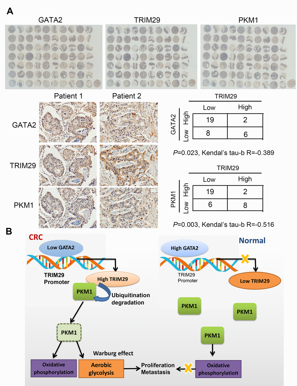 TRIM29 protein negatively correlates with GATA2 protein and PKM1 protein in CRC. (A) IHC results of TRIM29, GATA2 and PKM1 in the tissue array. (B) Model of the GATA2-TRIM29-PKM1 axis in CRC. The statistical analysis was performed using the Kendual’s tau-b test. *P P 
