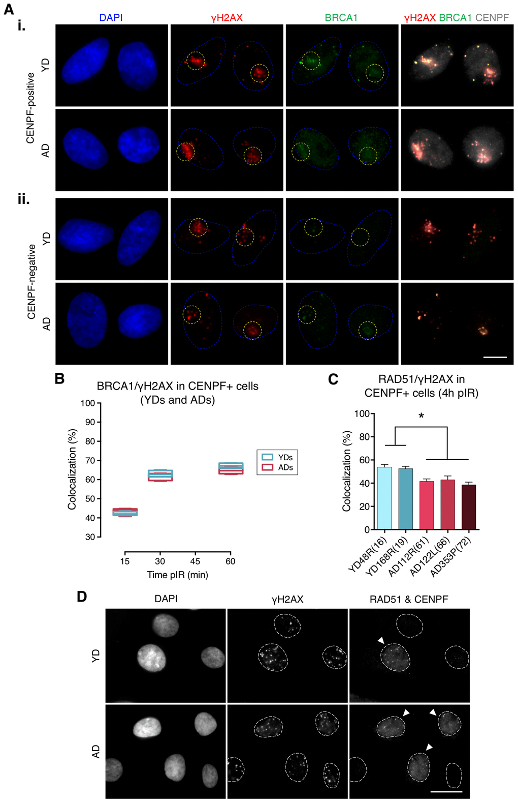Recruitment of BRCA1 to DNA damage sites in G2 is not impaired in cells from aged donors. (A) Immunofluorescent labeling of cell nuclei (DAPI, blue), γH2AX (A594, red), BRCA1 (A488, green) and CENPF (A532, grey). γH2AX and BRCA1 foci were scored within the irradiated pore zone (yellow dotted lines) in CENPF-positive (i) or CENPF-negative (ii) cells. Scale bar = 10 μm. (B) Percentage of BRCA1/γH2AX foci colocalization in CENPF-positive HMECs from four YDs and four ADs. Boxes include data from the upper to the lower quartile and whiskers compile minimum to maximum values (n is stated in Supplementary Table 3). (C) Percentage of RAD51/γH2AX foci colocalization in CENPF-positive cells at 4 h after irradiation (5 Gy, γ-rays). Error bars indicate SEM (* p n ≥ 500 γH2AX foci/donor; one-way ANOVA + Tukey). (D) Immunofluorescent labeling of cell nuclei (DAPI), γH2AX (A488), RAD51 (A594) and CENPF nuclear staining (A532) at 4 h after exposure to 5 Gy of γ-rays. Arrowheads indicate G2 (CENPF-positive) cells. Scale bar = 20 μm.