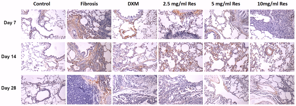 HIF-1α was overexpressed in the rat fibrosis model. The expression of HIF-1α was measured by immunohistochemistry on days 7, 14, and 28 following different treatments. Scale bar = 200 μm.