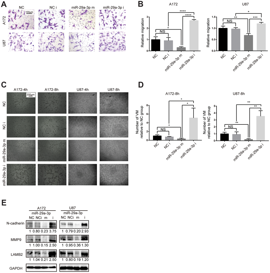 miR-29a-3p inhibited migration and VM formation in glioma cells. (A) The effect of miR-29a-3p on cell movement was assessed using transwell migration assays (scale bar, 100 μm; n=3). (B) Quantification of transwell migration assays in (A). Data are shown as the mean±SD, n=3, one-way ANOVA (*, P C) Effect of miR-29a-3p on VM formation ability (scale bar, 200 μm; n=3). (D) Quantification of relative VM number in (C). Data are shown as the mean±SD, n=3, one-way ANOVA (*, P E) Western blot analysis of protein levels of N-cadherin, MMP9 and LAMB2 in A172 and U87 cells. GAPDH was used as a whole-cell protein loading control. Results are from three independent experiments.