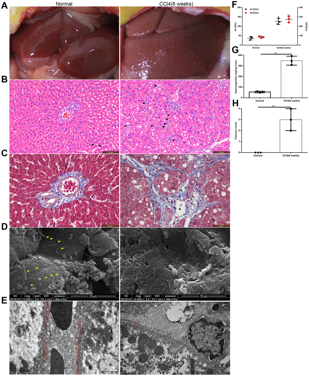 Establishment of the rat model of liver fibrosis. (A) General appearance of liver in the model group and the normal control group. (B, C) HE and Masson staining of liver tissues from the model group and normal control group: inflammatory cells accumulated in the hepatic sinusoids and collagen fibers deposited in the space of Disse (the black head of arrow indicates infiltrating lymphocytes). (D) SEM: defenestration changes in the model group compared with those in the normal control group (the yellow head of arrow indicates fenestrae). (E) TEM: formation of a basement membrane in the model group compared with that in the normal control group (the red irregular area in the normal control group indicated LSECs; and in the model group, the red arrow showed the discontinuous basement membrane). (F) Transaminase levels in the model group and the normal control group. (G) Hydroxyproline content in the model group and the normal control group. (H) Liver fibrosis score in the model group and the normal control group. **p 