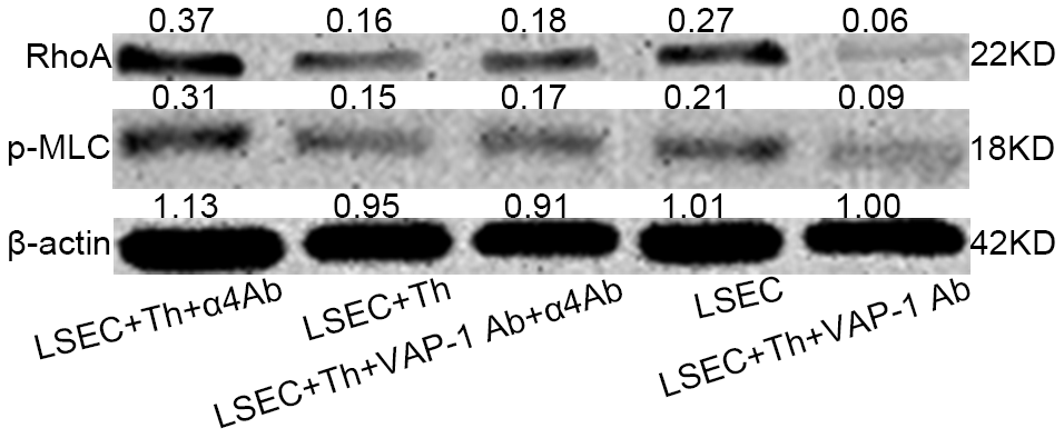 Western blot analysis of RhoA and p-MLC levels of isolated LSECs in each group in the co-cultivation systems. The level was higher in Lane 1 (anti-integrin α4 antibody group) than in lane 4 (pure isolated LSECs from fibrotic rats). And the level was lowest in lane 5 (anti-VAP-1 antibody group).