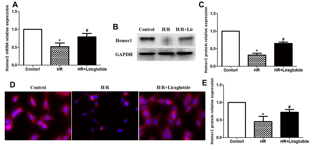 Liraglutide promoted expression of Homer1 in H9C2 cells against H/R. H9C2 cells were pretreated with 200 nmol/L liraglutide or vehicle 30 min before H/R treatment, and the expression of Homer1 mRNA (A), protein (B, C), and intracellular localization (D, E) were examined by RT-qPCR, western blot and immunofluorescence staining.