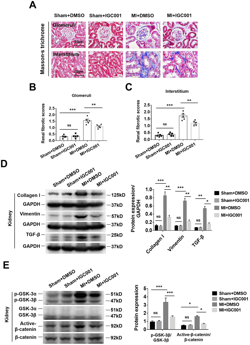 Activation of fibrosis-related signaling pathways can be prohibited by β-catenin inhibitor IGC001 (5 mg/kg/d) in the kidneys at 12 weeks after MI. (A) Representative photomicrographs of renal fibrosis detected by Masson’s trichrome stain in sham mice or CRS mice treatment with IGC001 or DMSO. Semi-quantitative assessment of glomerular fibrosis (B) and interstitial fibrosis (C). **P ***P D) Western blot of collagen I, vimentin and TGF- β. (E) Western blot of p-GSK-3β and active-β-catenin. *P **P ***P 