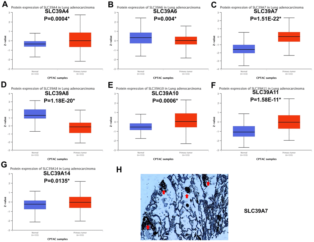 Protein expression of SLC39A genes in patients with lung adenocarcinoma. (A) SLC39A4. (B) SLC39A6. (C) SLC39A7. (D) SLC39A8. (E) SLC39A10. (F) SLC39A11. (G) SLC39A14. (H) Immunohistochemical staining of SLC39A7 proteins in lung adenocarcinoma tissue specimens. * P