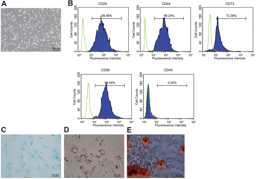 Isolation and identification of BMSCs. (A) condition of primary BMSCs after adherent growth for 7 d (100 ×); (B) expression of surface markers CD29, CD44, CD73, CD90, and CD45 in the BMSCs detected by flow cytometry; (C) Oil red O staining for the BMSCs after adipogenic induction (400 ×); (D) alizarin red staining for the BDMSCs after osteogenic differentiation (400 ×); (E) Alcian blue staining for BMSCs after chondrocyte induction (400 ×).