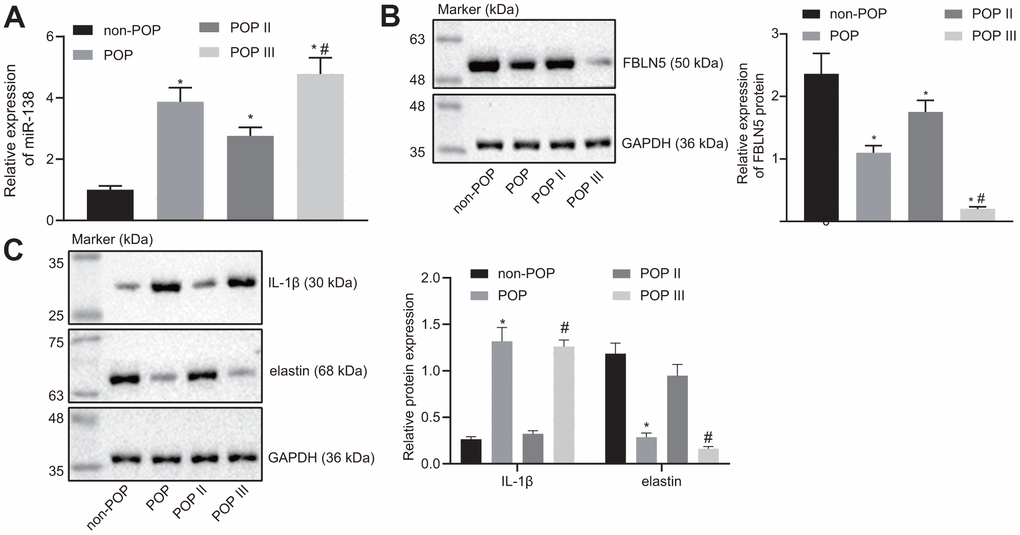 miR-138 and IL-1β are overexpressed and FBLN5 and elastin are repressed in POP patients. (A) miR-138 expression in patients with POP or non-POP controls measured by RT-qPCR, N = 46; (B) the protein expression of FBLN5 in patients with POP or non-POP controls measured by western blot analysis; (C) the protein expression of IL-1β and elastin in patients with POP or non-POP controls measured by western blot analysis. *p vs. non-POP controls; #p vs. POP II patients; statistical data were measurement data and calculated as mean ± standard deviation. The one-way ANOVA was adopted for comparison among multiple groups, followed by Tukey’s post hoc test.