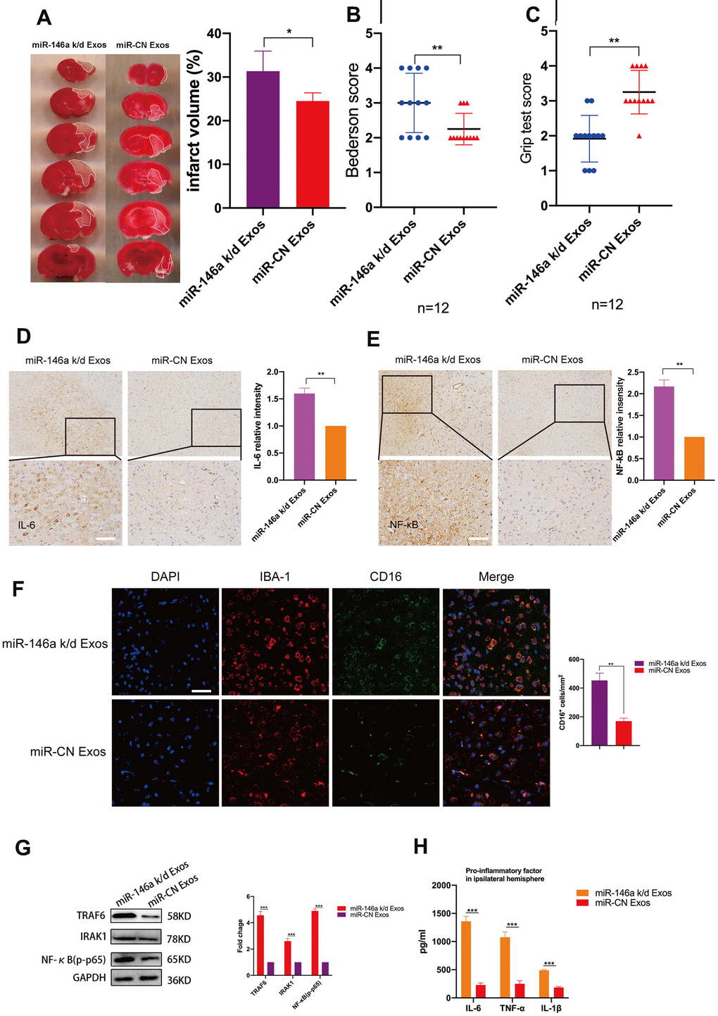 Treatment with hUMSC-Exos decreases neuroinflammation and is neuroprotective by down-regulating IRAK1/TRAF6 signaling pathway activity in vivo. (A) Representative photomicrographs of TTC-stained tissue from wild-type versus miR-146a-5p knockdown hUMSC-Exos groups, with infarct size as calculated using ImageJ software. Data are expressed as mean ± SEM (n = 6 per group). Significant differences are indicated (*p B, C) Neurological deficit scores in vehicle-only versus experimental groups at 72 hours post-reperfusion. Data are expressed as mean ± SEM (n = 12 per group). Significant differences are indicated (*p **p D, E) Representative photomicrographs of IL-6 and NFκB in the ischemic penumbra 72 hours post-reperfusion, with associated relative intensities as calculated using ImageJ software. Scale bar: 50 μm. Data are expressed as mean ± SEM (n = 6 per group). Significant differences are indicated (*p F) Microglial M1 markers IBA-1 and CD16 in the ischemic penumbra 3 days following ischemic stroke. (G) Expression of signaling pathway IRAK1, TRAF6, and NFκB (p65) in the wild-type versus miR-146a-5p knockdown groups. (H) Determination of IL-6, TNF- α, and IL-1β protein levels via ELISA. Data are expressed as mean ± SEM (experiments were performed in triplicate). Significant differences are indicated (*p 