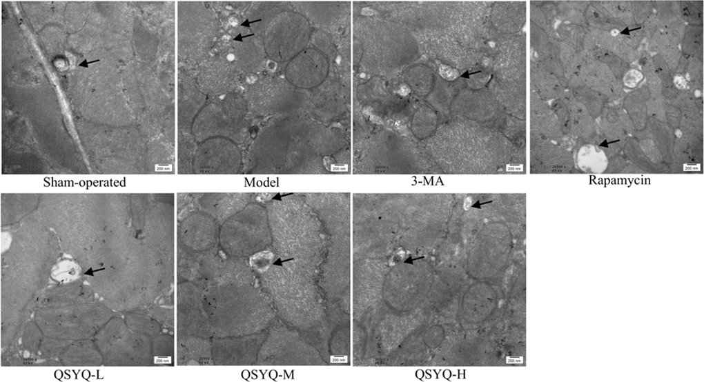 Effect of QiShen YiQi pill (QSYQ) on myocardial autophagy in rats. Transmission electron micrographs of rat myocardium in each group, the black arrow show autophagosomes, with a scale of 200nm.