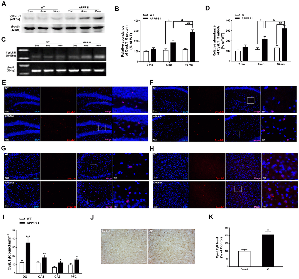 CysLT1R expression is upregulated in APP/PS1 mice and AD patients. (A) Representative immunoblots of CysLT1R protein in the hippocampus of APP/PS1 mice and WT mice at the age of 2, 6 and 10 months. (B) Quantification of CysLT1R protein levels was expressed as the ratio (in %) of WT group. Data are expressed as mean ± SEM, n = 4, *P ##P &P C) RT-PCR detection of CysLT1R mRNA in the hippocampus of APP/PS1 mice and WT mice at the age of 2, 6 and 10 months. (D) Quantification of CysLT1R mRNA levels was expressed as the ratio (in %) of WT group. Data are expressed as mean ± SEM, n = 4, *P  vs. 6-month-old WT mice; ##P &P 1R expression in the hippocampal DG (E), CA1 (F), CA3 (G), and prefrontal cortex (H) in APP/PS1 mice and WT mice. Scale bar = 50 μm. (I) Quantification of CysLT1R in the brain sections of mice. Data are expressed as mean ± SEM, n = 4, *P P P J) CysLT1R levels in the brain sections from post-mortem AD patients and normal controls by immunohistochemical analyses. Scale bar = 100 μm. (K) Quantification of CysLT1R in the sections of human postmortem brains. Data are expressed as mean ± SEM, n = 4, **P