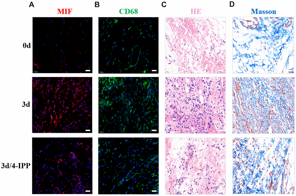 Inhibition of MIF in the lesion area attenuated posterior joint capsule inflammation and fibrosis. (A) Expression of MIF (red) in the posterior joint capsule was assessed via immunostaining at 0 d, 3 d and 3 d after injection of 4-IPP. (B) Immunostaining of CD68-positive macrophages (green) in the posterior joint capsule. (C) HE staining of the posterior joint capsule. (D) Masson staining of the posterior joint capsule. Scale bars, 20 μm.