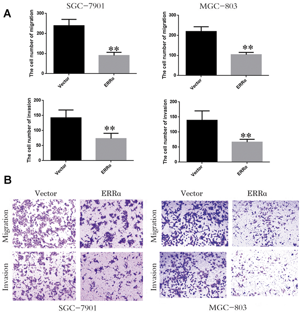 Low expression of ERRα inhibits the cell migration and invasion. (A) The cell number of migration and invasion in SGC-7901 cell and MGC-803. (B) The migration and invasion ability of SGC-78901 and MGC-803 cells were observed by crystal violet staining **P