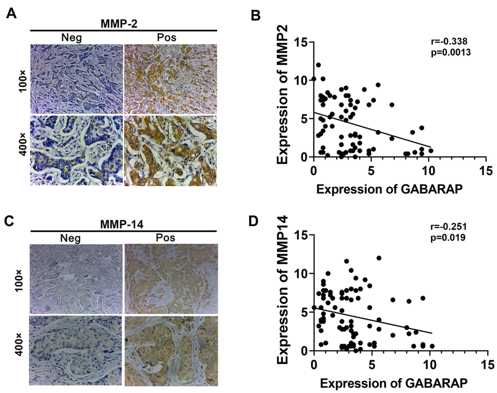 Correlation between MMPs and GABARAP expression in breast cancer tissues from patients. (A) Representative immunostaining profiles of MMP2 in GABARAP low expression and GABARAP high expression breast cancer tissues. Magnification, 100× and 400×. (B) Correlation analysis of the expression of MMP2 and GABARAP using the Pearson correlation coefficient. GABARAP negatively correlated with MMP2 at the protein level. (C) Representative immunostaining profiles of MMP14 in GABARAP low expression and GABARAP high expression breast cancer tissues. Magnification, 100× and 400×. (D) Correlation analysis of the expression of MMP14 and GABARAP using the Pearson correlation coefficient. GABARAP negatively correlated with MMP14 at the protein level.