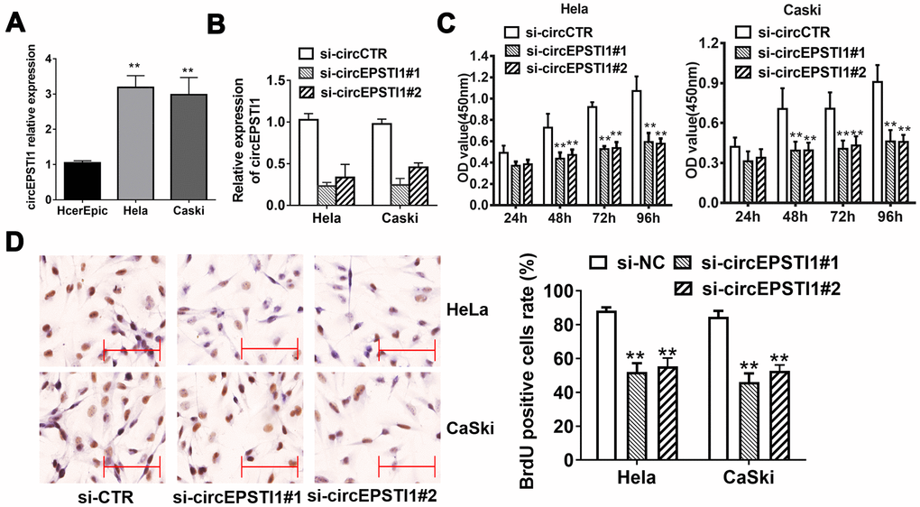 CircEPSTI1 is highly expressed in cervical cancer cells and silencing of circEPSTI1 inhibits cell proliferation. (A) CircEPSTI1 expression in 2 cervical cancer cell lines (CaSki, HeLa) and normal cell line (HcerEpic) examined by qRT-PCR. (B) Knockdown efficacy of two distinct si-circEPSTI1 evaluated by RT-qPCR. (C) CCK-8 assay in HeLa and CaSki cells transfected with circEPSTI1 siRNAs or control. (D) HeLa and CaSki cancer cells were co-transfected with si-control, si- circEPSTI1 mimics. BrdUrd incorporation was evaluated via IHC to assess cell growth after transfection with the si-circEPSTI1 or si-control at 48 hours. **, P 