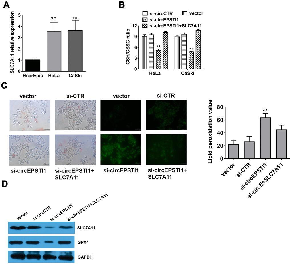 Silencing of circEPSTI1 induces ferroptosis mediated by SLC7A11. (A) SLC7A11 mRNA level in cervical cancer cell lines were detected by qRT-PCR analysis. (B) The glutathione (GSSG) to reduced glutathione (GSH) ratio in HeLa cells was detected by GSH/GSSG assay. (C) Immunofluorescence images of HeLa cells treated for si-circEPSTI1, SLC7A11 and vector and stained with liperfluo were shown; scale bar: 50 μm. (D)The effect of circEPSTI1 knockdown on SLC7A11 and GPX4 protein level in HeLa cells. **, P 
