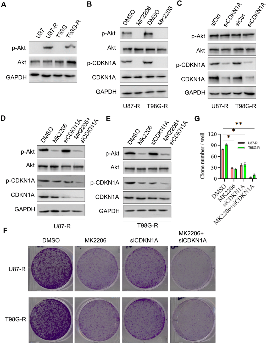 CDKN1A was involved in TMZ resistance of glioma cells. (A) Western blot for phospho-Akt (Ser-473), Akt in U87, U87-R T98G, and T98G-R cells. (B) Western blot for phospho-Akt (Ser-473), Akt, phospho-CDKN1A, and CDKN1A in U87-R or T98G-R cells treated with DMSO and the specific inhibitor to AKT MK2206. (C) Western blot for phospho-Akt (Ser-473), Akt, phospho-CDKN1A, and CDKN1A in U87-R or T98G-R cells treated with siCtrl and siCDKN1A. (D) Western blot for phospho-Akt (Ser-473), Akt, phospho-CDKN1A, and CDKN1A in U87-R cells treated with DMSO, MK2206, siCDKN1A and MK2206 plus siCDKN1A. (E) Western blot for phospho-Akt (Ser-473), Akt, phospho-CDKN1A, and CDKN1A in T98G-R cells treated with DMSO, MK2206, siCDKN1A and MK2206 plus siCDKN1A. (F, G) Colony formation assay of U87-R or T98G-R cells treated with DMSO, MK2206, siCDKN1A and MK2206 plus siCDKN1A. The results were presented as means ± SD (n = 3 for each panel). Statistical significance was concluded at *P 