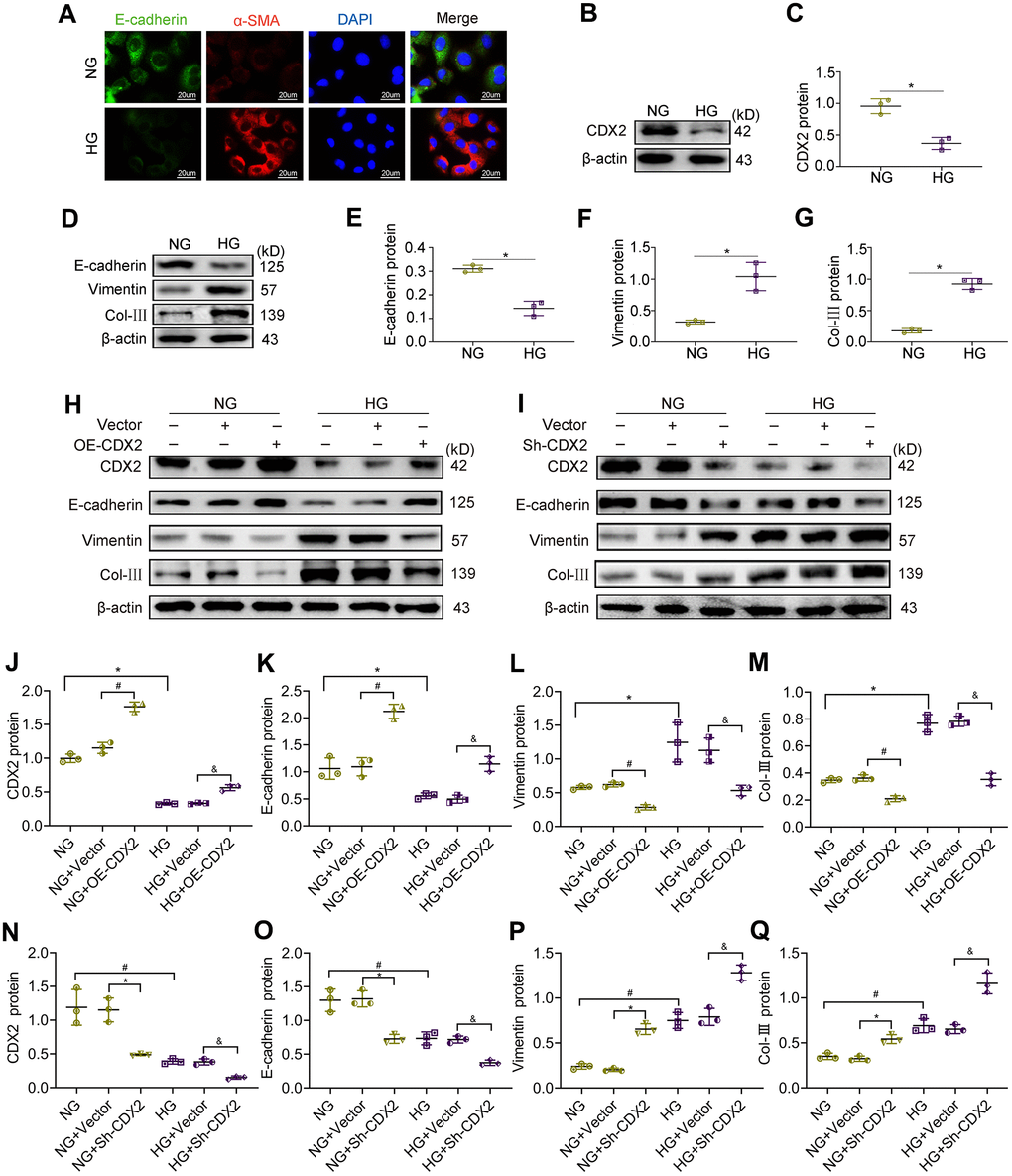 CDX2 overexpression alleviates hyperglycemia-induced RTECs damage, and CDX2 knockdown aggravates the damage. NRK-52E cells were administered NG (5.5 mM) and HG (25 mM) media for 48h, followed by analysis. (A) Immunofluorescence for E-cadherin and α-SMA detection in NRK-52E cells of the NG and HG groups, respectively (scale bar, 20μm). (B, C) Immunoblot bands of CDX2 (B) and quantitative data (C) in NRK-52E cells of the NG and HG groups. (D–G) Immunoblot bands of E-cadherin, Vimentin, and Col-III (D), and quantitative data (E–G) in NRK-52E cells of the NG and HG groups. H-Q Immunoblot bands of CDX2, E-cadherin, Vimentin, and Col-III in non-transfected (NG or HG treated) NRK-52E cells, and NRK-52E cells transfected with Vector (NG+Vector group, HG+Vector group), or CDX2-overexpressing (NG+OE-CDX2 group, HG+OE-CDX2 group) or CDX2-knockdown (NG+Sh-CDX2 group, HG+Sh-CDX2 group) (H, I); quantitative data are shown (J–Q). Data are mean±SD from three assays performed independently. n=3; *P#P&P