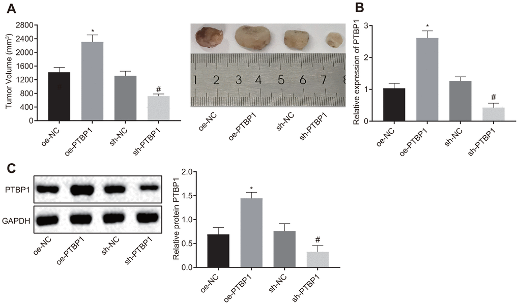 PTBP1 promotes chemoresistance of osteosarcoma cells to DXR in vivo. Nude mice were were subcutaneously inoculated with PTBP1-overexpressed or PTBP1-depleted U2OS cells. (A) Tumor volume in nude mice. (B) PTBP1 mRNA level (normalized to GAPDH) in xenograft tumors determined by RT-qPCR. (C) PTBP1 protein level (normalized to GAPDH) in xenograft tumors determined by Western blot analysis. Values obtained from three independent experiments in triplicate are analyzed by unpaired t test. *p 
