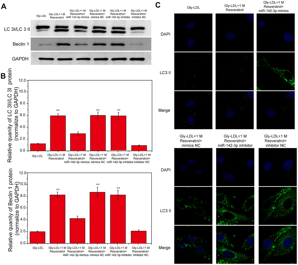 Overexpression of miR-142-3p reverses the effect of resveratrol on the autophagy and cell cycle of HUVEC cells induced by Gly-LDL. (A) The expression of LC3 II/I and BECLIN1 in all groups by western blotting. (B) Statistical analysis of Western blotting results. (C) Immunofluorescence detection of LC3. *, P 