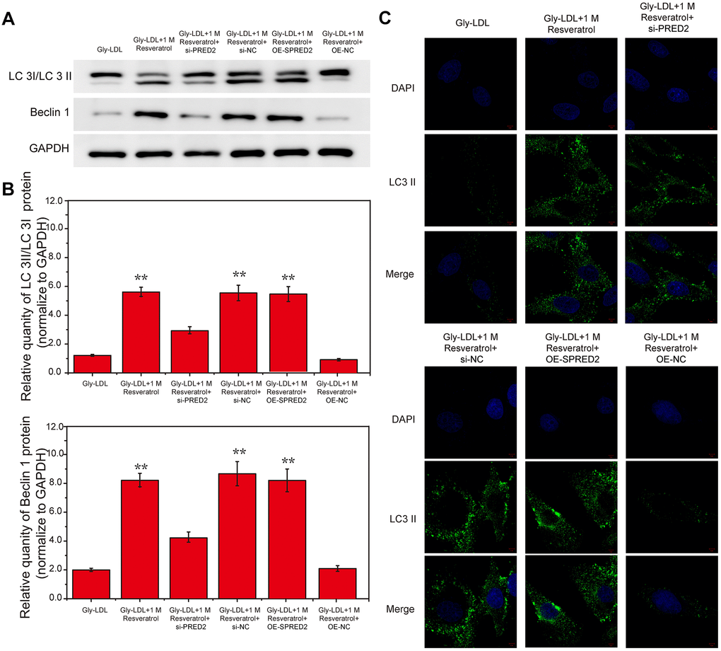 Inhibition of SPRED2 reverses the effect of resveratrol on the autophagy, senescence and cell cycle of HUVEC cells induced by Gly-LDL. (A) The expression of LC3 II/I and BECLIN1 in all groups by western blotting. (B) Statistical analysis of Western blotting results. (C) Immunofluorescence detection of LC3. *, P 
