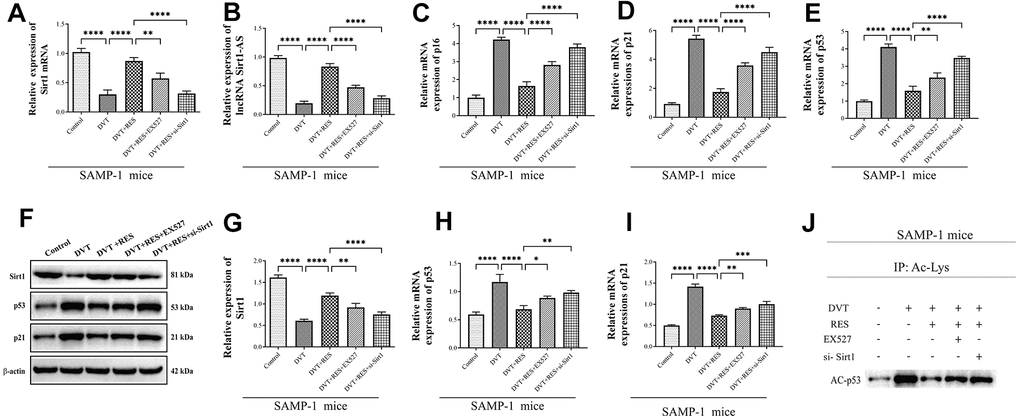 LncRNA Sirt1-AS expression and Sirt1 activation in different groups of SAMP-1 mice. (A) Relative mRNA expression of Sirt1. (B) Relative expression of lncRNA Sirt1-AS. (C–E) Relative mRNA expression of p16, p53 and p21. (F–I) Relative protein expression of Sirt1, p16, p53, and p21. (J) p53 acetylation was detected. Error bars represent SD. *, p