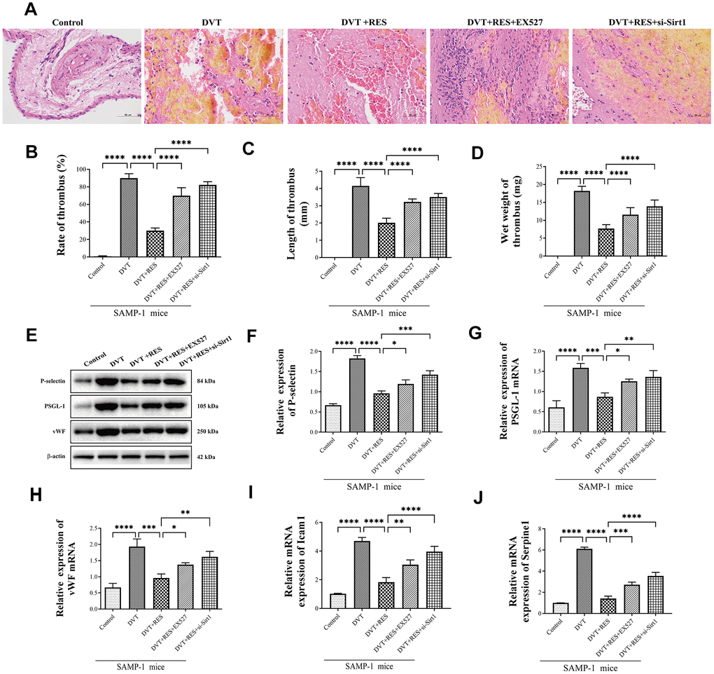 Sirt1 activation suppresses DVT in SAMP-1 mice. (A) HE staining of endothelia in different groups of SAMP-1 mice (40*). (B–D) mRNA and protein expression of P-selectin, PSGL-1 and vWF in different groups of SAMP-1 mice. (E–H) The rate of thrombus, length and wet weight of thrombus in different groups of SAMP-1 mice. (I, J) mRNA expression of senescence associated genes Icam1 and Serpine1. Error bars represent SD. *, p