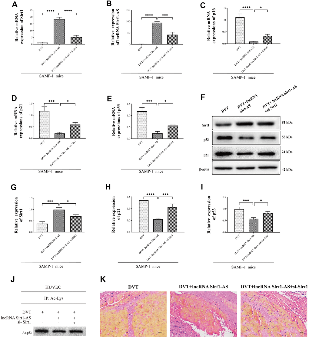 Sirt1 is upregulated by lncRNA Sirt1-AS overexpression. (A, B) Expression of Sirt1 mRNA and lncRNA Sirt1-AS. (C–E) Relative mRNA expression of p16, p53 and p21. (F–I) Protein levels of Sirt1, p16, p53 and p21. (J) p53 acetylation was detected. (K) HE staining of endothelia of SAMP-1 mice. (40*). Error bars represent SD. *, p