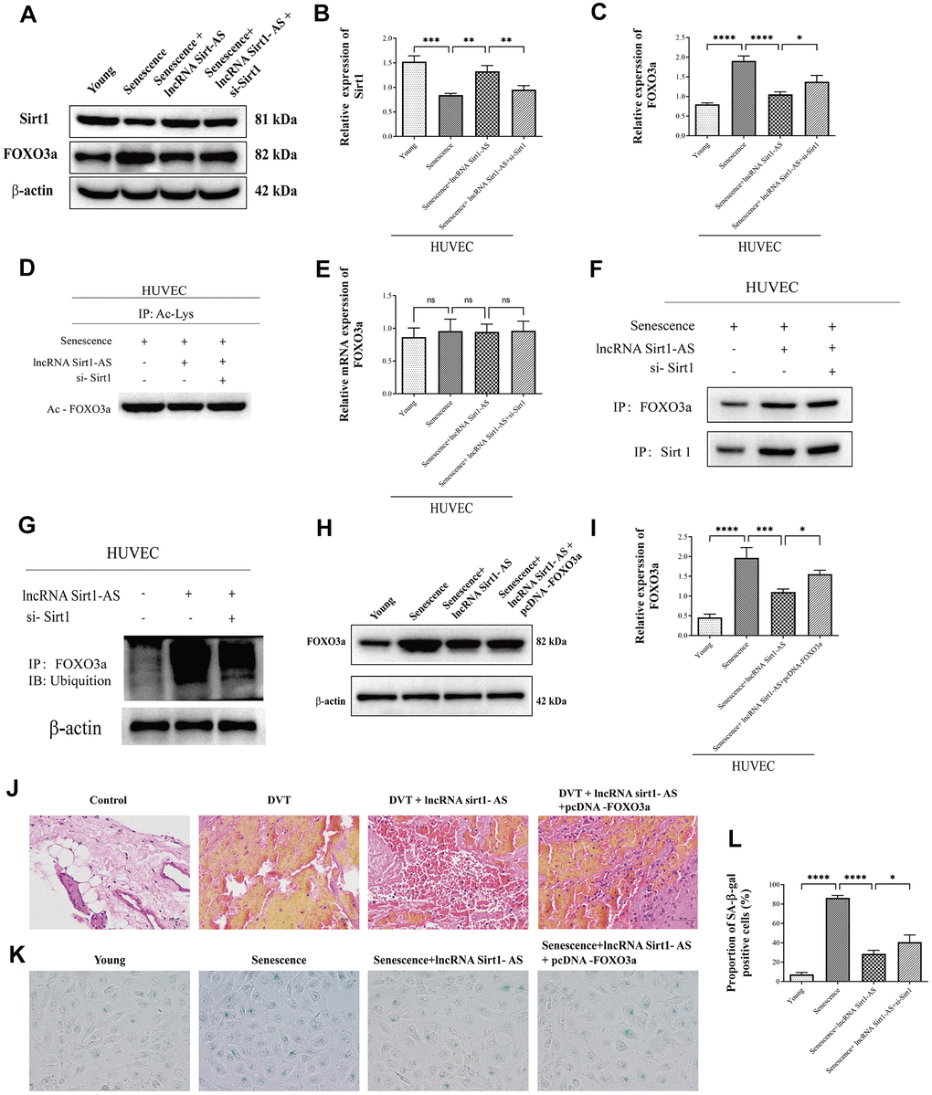 LncRNA Sirt1-AS regulated DVT through FOXO3a ubiquitination and degradation (A–D) Protein expression of Sirt1, FOXO3a and its acetylation were detected. (E) Relative mRNA expression of FOXO3a. (F) Co-IP was performed to detect the interaction of Sirt1 and FOXO3a. (G) Western blot was used to detect the FOXO3a ubiquitination level. (H, I) Western blot was used to detect the protein expression of FOXO3a after pcDNA3.1-FOXO3a transfection. (J) HE staining of endothelia of SAMP-1 mice. (40*) (K, L) proportion of SA-β-Gal positive cells. Error bars represent SD. *, p