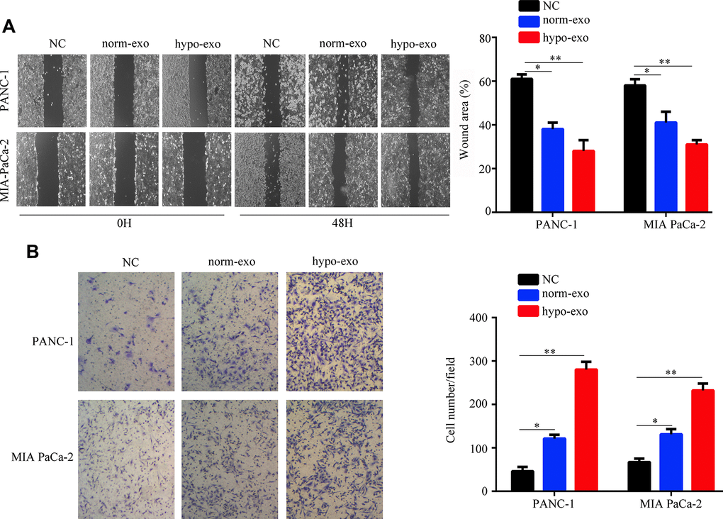 Hypoxic PSC-derived exosomal miR-4465 and miR-616-3p promote migration and invasion in PC cells. PANC-1 and MIA PaCa-2 cells were treated with exosomes secreted from hypoxic and normoxic PSCs. EV-depleted complete medium was used as control. (A) Results of wound-healing migration assays (magnification: 40×). (B) Results of Transwell invasion assays (magnification: 40×). *P