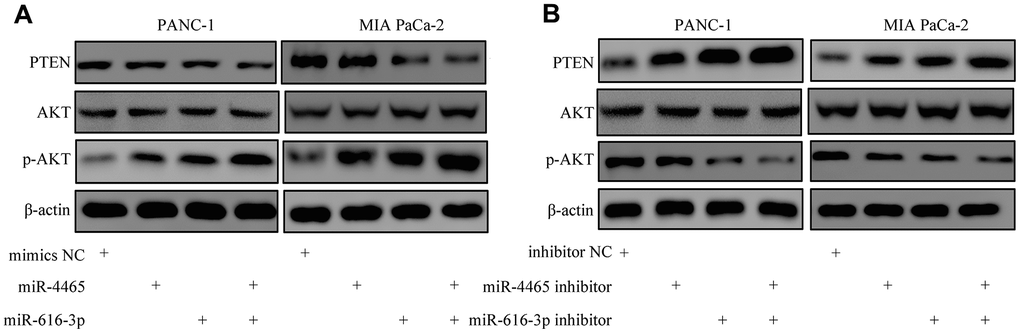 MiR-4465 and miR-616-3p downregulate PTEN and activate AKT in PC cells. (A) Western blot analysis of PTEN, AKT, and p-AKT expression in PANC-1 and MIA PaCa-2 cells transfected with miR-4465, miR-616-3p, or negative control (NC) mimics. (B) Western blot analysis of PTEN, AKT, and p-AKT expression in PANC-1 and MIA PaCa-2 cells transfected with miR-4465 inhibitor, miR-616-3p inhibitor, or the corresponding negative controls (NC) prior to treatment with hypoxic PSC-derived exosomes. *P