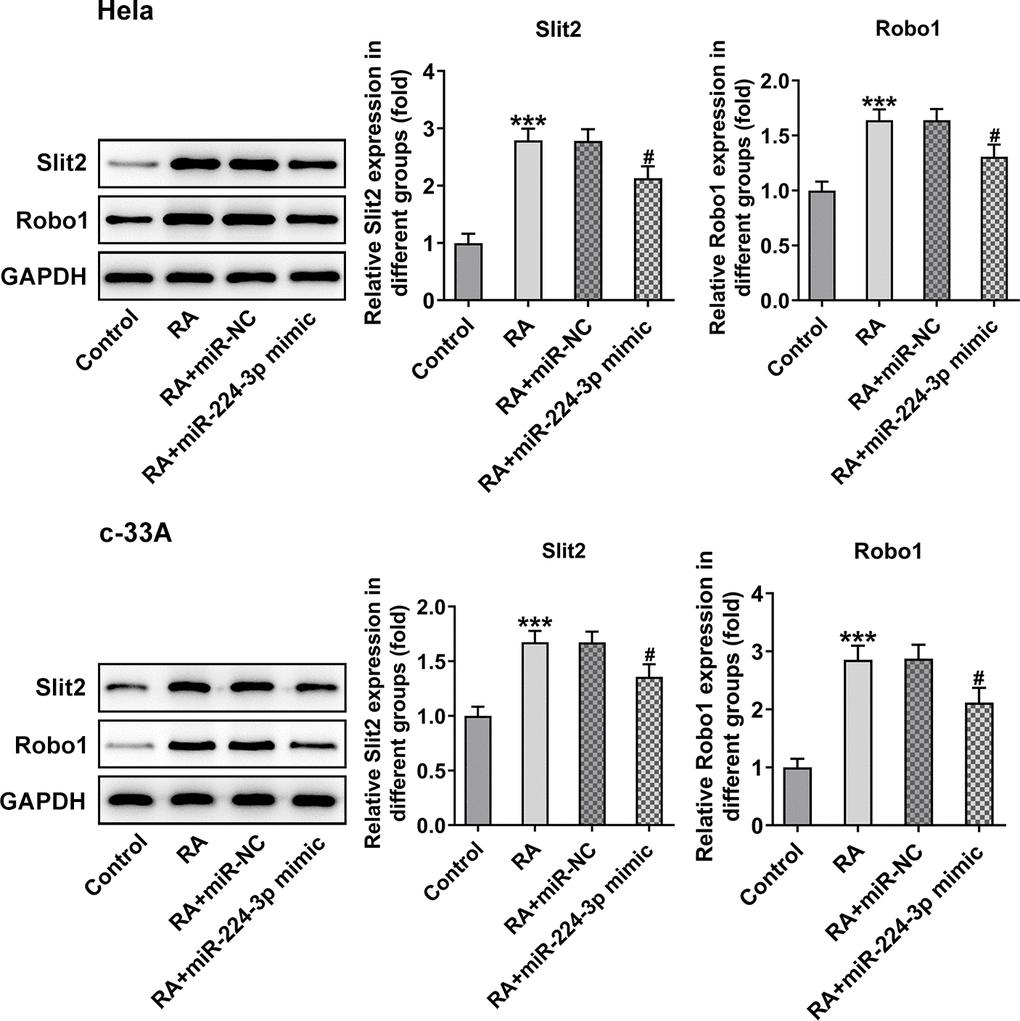 Overexpression of miR-224-3p restores the expression of Slit2 and Robo1 in CC cells induced by RA. The expression of Slit2 and Robo1 in Hela and c-33A cells was detected by western blot analysis. *P#P