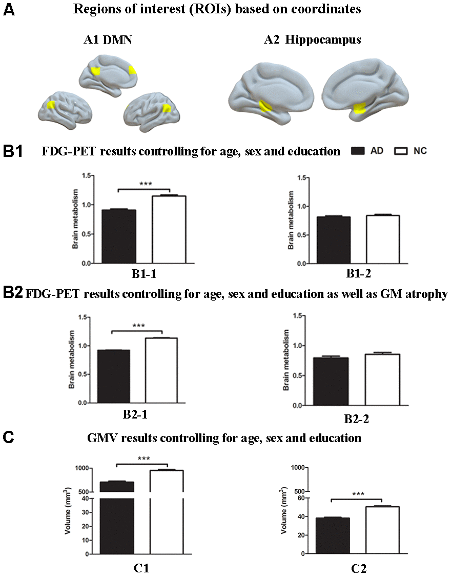 Group differences in18F-FDG SUVR and gray matter volume by using ROI analysis based on coordinates between the AD group and the NC group. (A) ROIs of the DMN (A1) and hippocampus (A2) were defined based on coordinates (shown in warm yellows). (B1) Metabolism results of the DMN (B1-1) and hippocampus (B1-2) controlling for age, sex and education. (B2) Metabolism results of the DMN (B2-1) and hippocampus (B2-2) controlling for age, sex and education as well as gray matter atrophy. (C) Gray matter volume results of the DMN (C1) and hippocampus (C2) controlling for age, sex and education. Bars represent average metabolism or total gray matter volume and error bars indicate standard error. ***P 