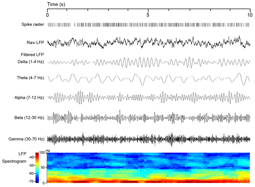 Local field potential (LFP) filtering process is illustrated as a representative 10-s signal in resting state with synchronously recorded spike raster and an LFP spectrogram.
