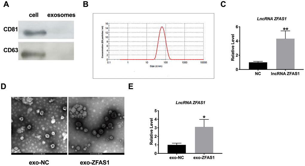 Isolation and characterization of exosomes derived from HCMs. (A) CD81 and CD63 were detected by western blot. (B) Exosome particle size detection. (C) The expression level of lncRNA ZFAS1 was detected in HCMs. (D) TEM was used to determine the existence and morphology of exosomes. (E) The expression level of lncRNA ZFAS1 was detected in exosome. *P