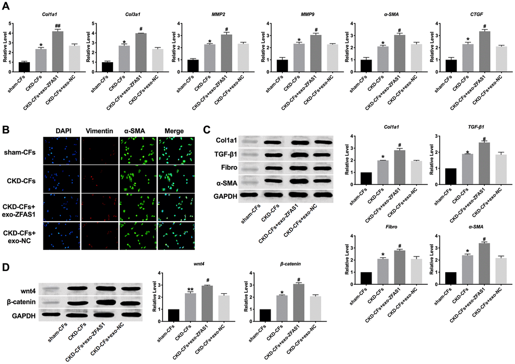 Exosome-lncRNA ZFAS1 promoted fibrosis in ex-vivo. (A) RT-PCR assay was performed to measure the expression of Col1a1, Col3a1, MMP2, MMP9, α-SMA, and CTGF. (B) The represented image of immunofluorescence for staining vimentin and α-SMA. (C) The expression level of Col1a1, TGF-β1, Fibronectin, α-SMA were assessed in CFs. (D) The effect of exosome-lncRNA ZFAS1 on the wnt4/β-catenin signal pathway. *P