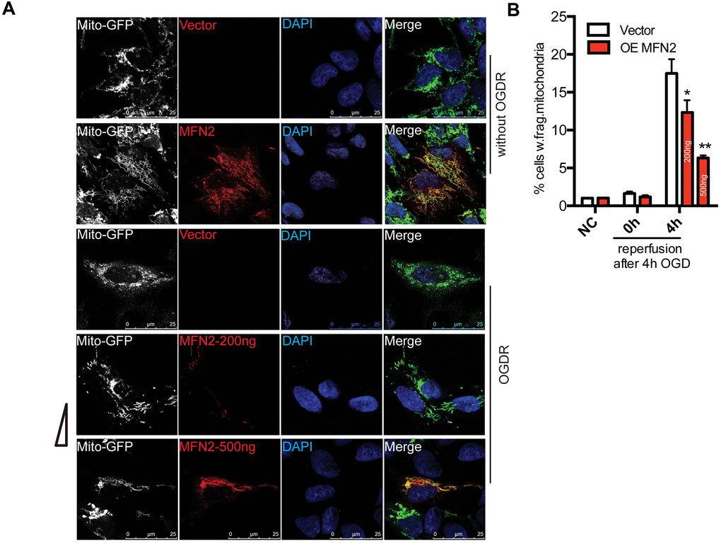 Effect of MFN2 overexpression on mitochondrial morphology in SK-N-BE(2) cells exposed to OGDR. SK-N-BE(2) cells were transfected with MFN2-Myc(200ng or 500ng) and Mito-GFP plasmids. After transfection 36 h, cells were treated with 4 h OGD plus reperfusion. (A) Digital photomicrograph under fluorescent illumination showed the morphology of mitochondria by mito-GFP. Most SK-N-BE(2) cells transfected with vector without OGDR displayed normal mitochondria, while fragmented mitochondria were evident in SK-N-BE(2) cells transfected with vector subjected to 4 h reperfusion after 4 h OGD. However, MFN2(200ng or 500ng) transfection significantly increased the number of SK-N-BE(2) cells with typical tubular and long mitochondria in a dose-dependent manner. (B) Quantitation (Mean ± SEM) of A from three independent experiments. Transfection with MFN2(200ng or 500ng) significantly attenuated OGDR-induced fragmentation of mitochondria in a dose-dependent manner. OE: over expression.
