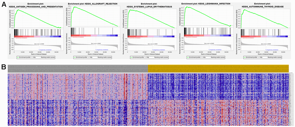 Significant RRM2-related genes and corresponding hallmark pathways in KIRC samples identified via GSEA. (A) Enrichment plots for the most significant pathways involving RRM2-related genes. (B) Heatmap showing transcriptional expression profiles of the top 50 genes for each phenotype.