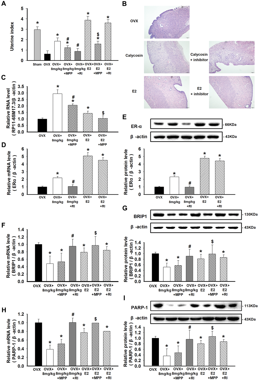Effects of calycosin on OVX rats and the activation of the RP11-65M17.3-ERα loop in aortic ECs. (A) OVX rats were treated for 20 days with calycosin (0 or 8 mg/kg), 8 mg/kg calycosin and 5 mg/kg MPP, 8 mg/kg calycosin and RP11-65M17.3 shRNA, 20 μg/kg E2, 20 μg/kg E2 and 5 mg/kg MPP, 20 μg/kg E2 and RP11-65M17.3 shRNA. The uterine index was calculated by the percentage of the uterus weight relative to the body weight. (B) The uterine tissues were stained with HE. (C–I) The levels of RP11-65M17.3, ERα, BRIP1 and PARP-1 in aortic ECs were determined using qRT-PCR or Western blotting. Representative data from three independent experiments are shown. *p #p $p 2.