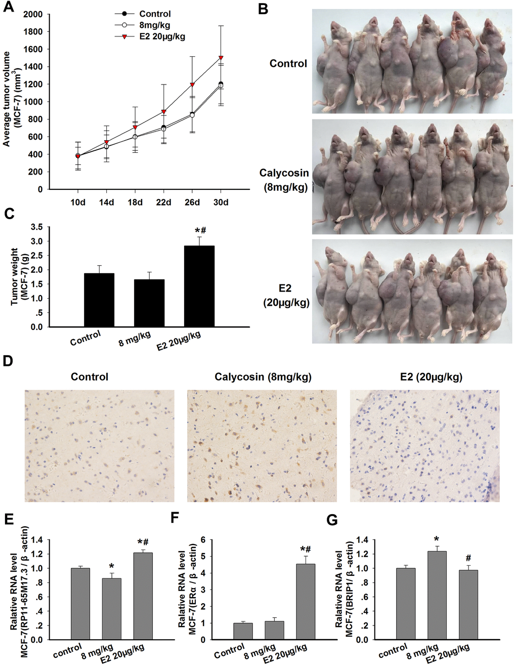 Effects of calycosin on xenograft tumor growth and the expression levels of RP11-65M17.3, ERα and BRIP1 in tumor tissue. (A–C) Nude mice bearing MCF-7-xenografted were treated for 20 days with calycosin (0 or 8 mg/kg) and 20 μg/kg E2. The tumor volume and tumor weight of the MCF-7 xenografts were measured (n = 6). (D) The tumor samples were subjected to IHC staining for BRIP1. (E–G) The mRNA expression levels of RP11-65M17.3, ERα and BRIP1 in the tumor tissues were determined using qRT-PCR, and β-actin served as the control. Representative data from three independent experiments are shown. *p #p 
