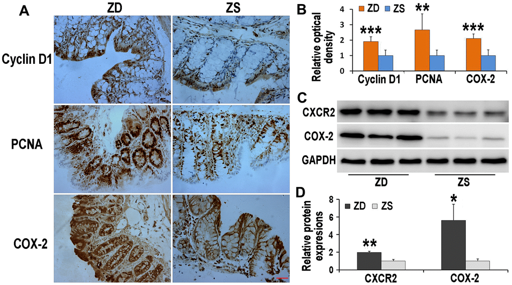 Effects of ZD on the expressions of Cyclin D1, PCNA, COX-2 and CXCR2. ZD increased the immunoreactivities of Cyclin D1, PCNA, and COX-2 in the colon of Apcmin/+ mice. (A) Immunoreactivities of Cyclin D1, PCNA, and COX-2 were detected by immunohistochemistry. (B) The data of relative optical density of immunoreactivities. n=6. (C) ZD increased expressions of CXCR2 and COX-2 in the colon of Apcmin/+ mice. Expressions of CXCR2 and COX-2 were detected by Western blot. GADPH was used to normalize the expression level. (D) The data of relative protein expression of Western blot. N=3. Data are showed as mean ± S.D., *P P P 