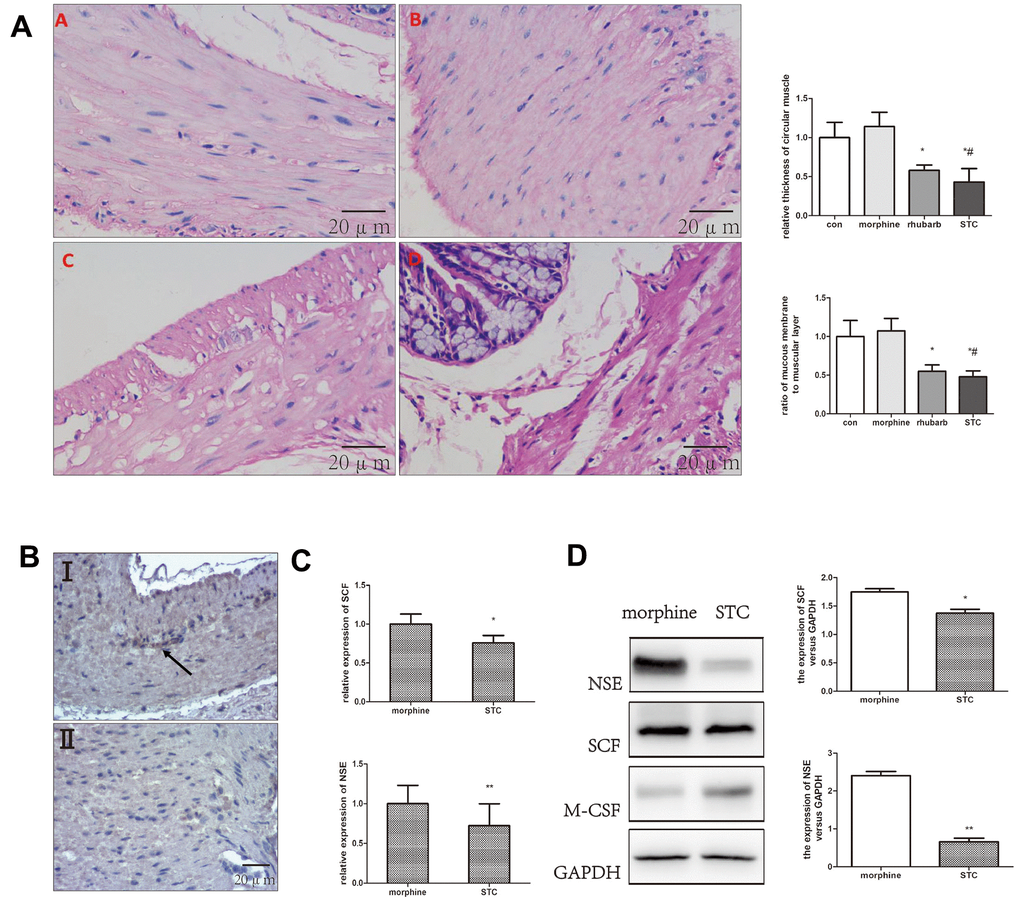 Differential expression of SCF, NSE in colonic samples. (A) HE staining performed on colonic tissues [original magnification ×40]. saline group (A), morphine group (B), rhubarb group (C), morphine+rhubarb group (D). (B) IHC staining (anti-SCF) performed on colonic tissues [original magnification ×40]. I morphine group, II: morphine+rhubarb group (STC). (C) the mRNA expression of SCF, NSE expression in cathartic colon mice models. (D) the protein expression of SCF, NSE in cathartic colon mice models. *PP