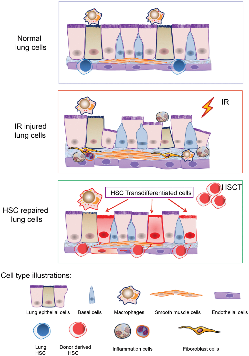 A cartoon illustrating HSCs transdifferentiation to pneumonocytes for irradiated lung repair. The cartoon illustrates HSCs transdifferentiate into the lung cells under certain injury such as irradiation. Irradiation induced lung bronchial epithelial cell structure destruction, inflammatory cell infiltration and fibrous hyperplasia and impaired HSC residency in the lung. After HSCT, donor HSCs migrate into the injured lung, and some of them can be transdifferentiated to lung epithelial and endothelial cells to repair the injury imposed by irradiation.