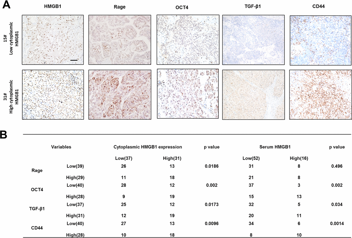 Extracellular HMGB1 promotes CD44 expression in hepatocellular ...