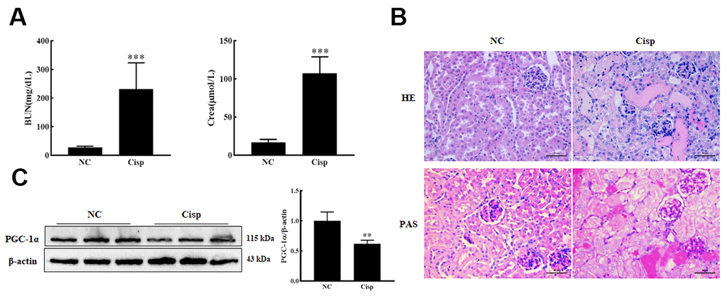 The expression of PGC-1α was down-regulated in AKI mice. The male C57BL/6 mice were injected with a single dose of cisplatin (16mg/kg, i.p.) to induce AKI and sacrificed on 4th day. (A) Serum BUN and Crea levels were quantified in each group (n=10). (B) Representative images of HE- and PAS-stained kidney sections. Scar bar: 50 μm. (C) Representative images of western blotting and the quantitative analysis of PGC-1α. Data are provided as the mean ± SEM, n=3 independent experiments. **P 