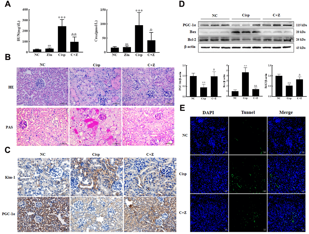 Oral administration of ZLN005 prevents cisplatin-induced AKI. The male C57BL/6 mice were injected once with cisplatin (16mg/kg, i.p.) to induce AKI, followed by ZLN005 treatment (15mg/kg/d, i.g.) for 4 days. (A) Serum BUN and Crea levels were quantified in each group (n=10). (B) Representative images of HE- and PAS-stained kidney sections. (C) Representative images of immunohistochemical staining using anti-Kim-1 and anti-PGC-1α antibodies. Scar bar: 20 μm. (D) Representative images of western blotting and the quantitative analysis of PGC-1α, Bax and Bcl-2. (E) Representative micrographs showing TUNEL staining. Data are provided as the mean ± SEM, n=3 independent experiments. *P &P &&P 