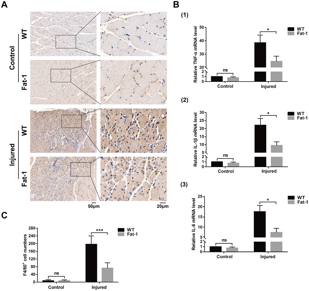 High endogenous n-3 PUFA levels reduce inflammation response to cardiotoxin-induced muscle injury in fat-1 mice. (A) Representative images show Immunohistochemical staining of the gastrocnemius muscle sections from fat-1 and wild-type mice with anti-F4/80 antibody on day 3 after CTX-induced muscle injury. Scale bar = 50 μm, 20 μm. (B) Quantitative data for F4/80-positive cell numbers. (C) Quantitative real-time PCR data shows the relative levels of TNF-α, IL-1β, and IL-6 in the gastrocnemius muscle tissues of fat-1 and wild-type mice on day 3 after CTX-induced muscle injury. Data were expressed as the mean ± SD (n = 3-4). NS, non-significant; * P P 