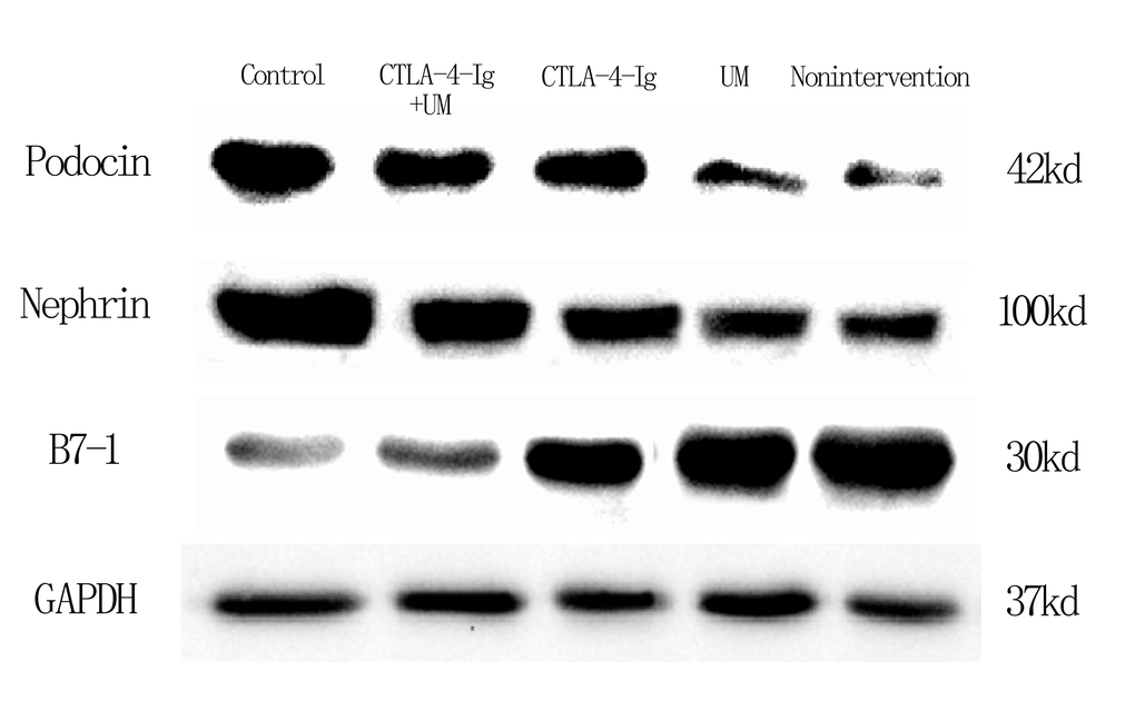 Expression of podocin, nephrin, and B7-1 proteins in rat kidneys with west-blot.